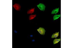ABIN7095075 and ABIN7099131 staining  cells by IF/ICC. (CRB3 anticorps)