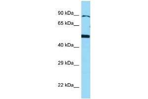 WB Suggested Anti-BMP4 Antibody Titration: 1. (BMP4 anticorps  (N-Term))
