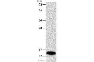 Western blot analysis of Mouse liver tissue, using SOD1 Polyclonal Antibody at dilution of 1:1160 (SOD1 anticorps)