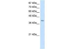 WB Suggested Anti-ERAL1 Antibody Titration:  0. (ERAL1 anticorps  (C-Term))