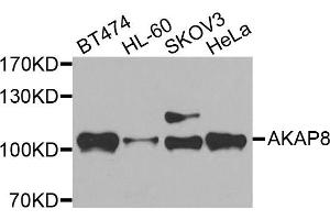 Western blot analysis of extracts of various cells, using AKAP8 antibody. (AKAP8 anticorps)