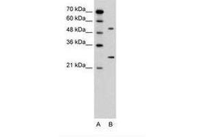 Image no. 2 for anti-Calcium Channel, Voltage-Dependent, beta 1 Subunit (CACNB1) (AA 201-250) antibody (ABIN6736600) (CACNB1 anticorps  (AA 201-250))