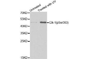 Western Blotting (WB) image for anti-ELK1, Member of ETS Oncogene Family (ELK1) (pSer383) antibody (ABIN1870156) (ELK1 anticorps  (pSer383))
