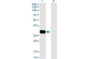 Western Blot analysis of RBPMS expression in transfected 293T cell line by RBPMS monoclonal antibody (M03), clone 1C12. (RBPMS anticorps  (AA 1-219))