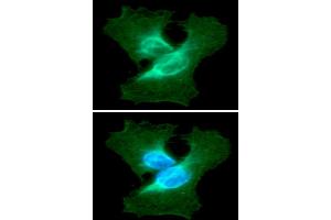ICC/IF analysis of VIM in HeLa cells line, stained with DAPI (Blue) for nucleus staining and monoclonal anti-human VIM antibody (1:100) with goat anti-mouse IgG-Alexa fluor 488 conjugate (Green).