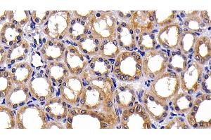 Detection of PKBa in Human Kidney Tissue using Polyclonal Antibody to Protein Kinase B Alpha (PKBa) (AKT1 anticorps  (AA 122-443))
