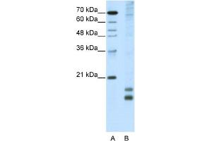 WB Suggested Anti-MAFF Antibody Titration:  5. (MafF anticorps  (N-Term))