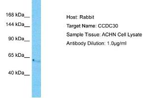 Host: Rabbit Target Name: CCDC30 Sample Tissue: Human ACHN Whole Cell  Antibody Dilution: 1ug/ml (CCDC30 anticorps  (C-Term))