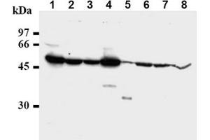 Western Blotting (WB) image for anti-Checkpoint Kinase 1 (CHEK1) antibody (ABIN487487)