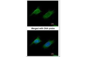 ICC/IF Image Immunofluorescence analysis of paraformaldehyde-fixed HeLa, using NAGLU, antibody at 1:200 dilution.