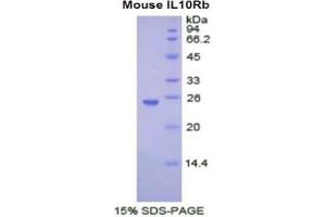 SDS-PAGE analysis of Mouse IL10Rb Protein. (IL10RB Protéine)