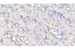 Detection of MYH9 in Human Stomach Tissue using Polyclonal Antibody to Myosin Heavy Chain 9, Non Muscle (MYH9)