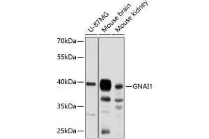 Western blot analysis of extracts of various cell lines, using GN antibody (ABIN6129386, ABIN6141198, ABIN6141199 and ABIN6224811) at 1:3000 dilution.