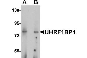 Western blot analysis of UHRF1BP1 in mouse kidney tissue lysate with UHRF1BP1 antibody at (A) 1 and (B) 2 µg/mL.