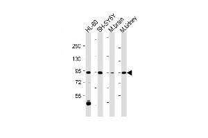 All lanes : Anti-ZPK Antibody (C-term) at 1:2000 dilution Lane 1: HL-60 whole cell lysate Lane 2: SH-SY5Y whole cell lysate Lane 3: Mouse brain lysate Lane 4: Mouse kidney lysate Lysates/proteins at 20 μg per lane. (MAP3K12 anticorps  (C-Term))