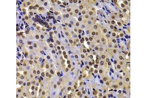 Immunohistochemistry of paraffin-embedded Mouse kidney using WHSC1 Polyclonal Antibody at dilution of 1:100 (40x lens). (WHSC1 anticorps)