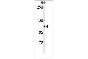 Image no. 1 for anti-Actinin, alpha 4 (ACTN4) (N-Term) antibody (ABIN360099) (alpha Actinin 4 anticorps  (N-Term))