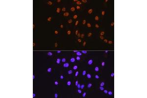 Immunofluorescence analysis of C6 cells using SP1 antibody (ABIN7270505).