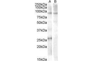 ABIN238679 (1µg/ml) staining of Human Heart lysate (35µg protein in RIPA buffer) with (B) and without (A) blocking with the immunising peptide.