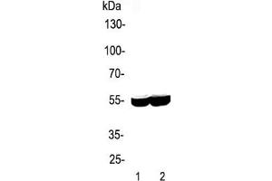 Western blot testing of 1) rat liver and 2) mouse liver lysate with CYP2E1 antibody.