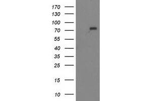 Western Blotting (WB) image for anti-Myotubularin Related Protein 2 (MTMR2) antibody (ABIN1499591) (MTMR2 anticorps)