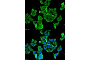 Immunofluorescence (IF) image for anti-Cell Division Cycle and Apoptosis Regulator 1 (CCAR1) antibody (ABIN1980350) (CCAR1 anticorps)