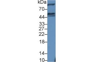 Detection of HEXa in Rat Cerebrum lysate using Polyclonal Antibody to Hexosaminidase A Alpha (HEXa) (Hexosaminidase A anticorps  (AA 318-529))