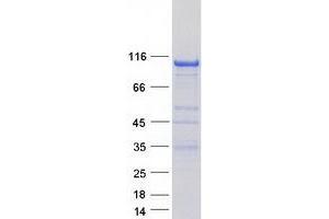Validation with Western Blot