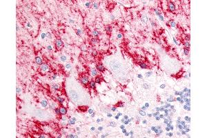 Anti-SLC1A3 / GLAST antibody IHC of human brain, cerebellum, molecular layer and Purkinje layer.