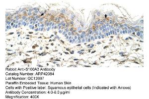 Rabbit Anti-S100A3 Antibody  Paraffin Embedded Tissue: Human Skin Cellular Data: Squamous epithelial cells Antibody Concentration: 4. (S100A3 anticorps  (N-Term))