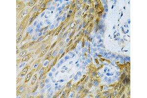 Immunohistochemistry of paraffin-embedded Human esophagus using HGF Polyclonal Antibody at dilution of 1:100 (40x lens).