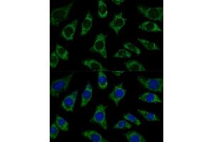 Immunofluorescence analysis of L929 cells using ETFB Polyclonal Antibody (ABIN7266916) at dilution of 1:100 (40x lens).