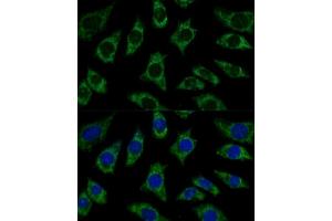 Immunofluorescence analysis of L929 cells using ETFB Polyclonal Antibody (ABIN7266916) at dilution of 1:100 (40x lens). (ETFB anticorps  (AA 80-230))