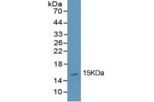 Rabbit Capture antibody from the kit in WB with Positive Control: Human lung tissue lysate. (PINP Kit ELISA)
