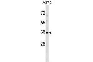 USP12 Antibody (Center) western blot analysis in A375 cell line lysates (35 µg/lane). (USP12 anticorps  (Middle Region))