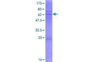 Image no. 1 for Coenzyme Q2 Homolog, Prenyltransferase (COQ2) (AA 1-371) protein (GST tag) (ABIN1350073)