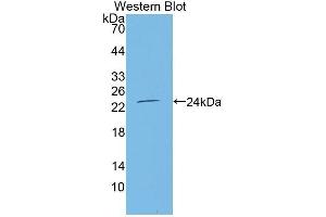 Western Blotting (WB) image for anti-Tumor Necrosis Factor Receptor Superfamily, Member 11a, NFKB Activator (TNFRSF11A) (AA 31-214) antibody (ABIN1863084) (TNFRSF11A anticorps  (AA 31-214))