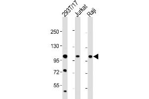 All lanes : Anti-REST Antibody (Center) at 1:2000 dilution Lane 1: 293T/17 whole cell lysate Lane 2: Jurkat whole cell lysate Lane 3: Raji whole cell lysate Lysates/proteins at 20 μg per lane. (REST anticorps  (AA 542-570))