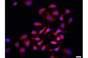 HepG2 cells were stained with PI3 kinase p85 alpha subunit Polyclonal Antibody, Unconjugated at 1:500 in PBS and incubated for two hours at 37°C followed by Goat Anti-Rabbit IgG (H+L) Cy3 conjugated secondary antibody.