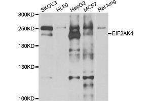 Western blot analysis of extracts of various cell lines, using EIF2AK4 antibody.