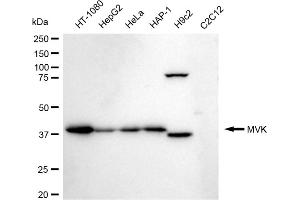 Western blotting analysis using MVK antibody (ABIN7799401). (Recombinant MVK anticorps)