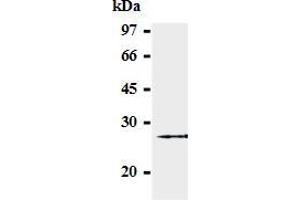 Western blot analysis of GST-SOCS-3 (2-44 a. (SOCS3 anticorps  (AA 2-44))