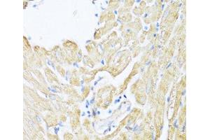 Immunohistochemistry of paraffin-embedded Rat heart using ALOX12 Polyclonal Antibody at dilution of 1:100 (40x lens). (ALOX12 anticorps)