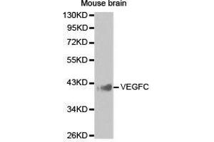Western Blotting (WB) image for anti-Vascular Endothelial Growth Factor C (VEGFC) antibody (ABIN1875325) (VEGFC anticorps)