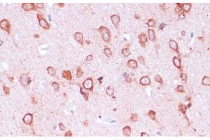 Immunohistochemistry of paraffin-embedded Rat brain using RPL21 Polyclonal Antibody at dilution of 1:100 (40x lens). (RPL21 anticorps)