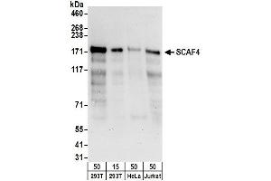 anti-SR-Related CTD-Associated Factor 4 (SCAF4) (AA 1075-1125) antibody