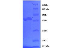 FK506 Binding Protein 1A, 12kDa (FKBP1A) (AA 2-103), (partial) protein (GST tag)