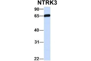 Host:  Rabbit  Target Name:  NOP56  Sample Type:  Human Fetal Brain  Antibody Dilution:  1.