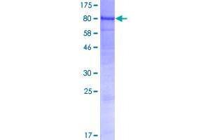 Image no. 1 for UDP-N-Acetyl-alpha-D-Galactosamine:polypeptide N-Acetylgalactosaminyltransferase 7 (GalNAc-T7) (GALNT7) (AA 1-639) protein (GST tag) (ABIN1354762)