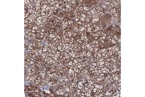 Immunohistochemical staining of human adrenal gland with EXOC6 polyclonal antibody  shows strong membranous and cytoplasmic positivity in cortical cells.
